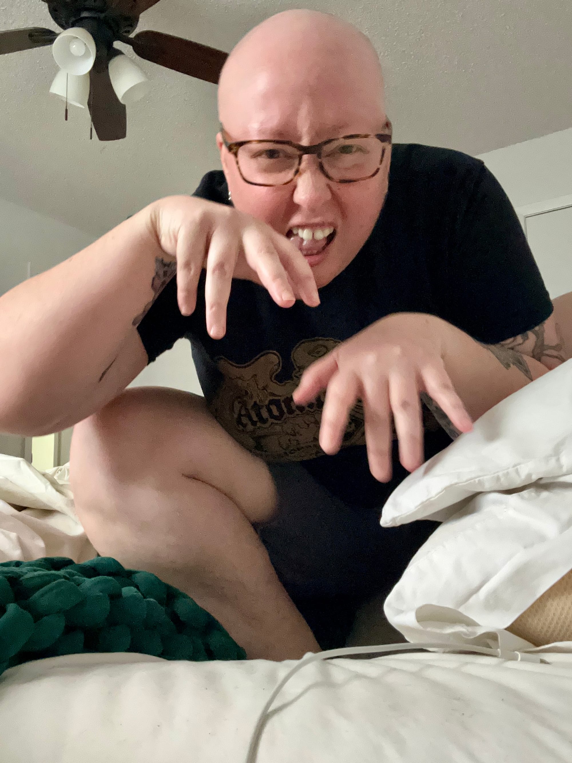 photo of me crouched on my bed in a goblin pose. I have no hair or eyebrows.